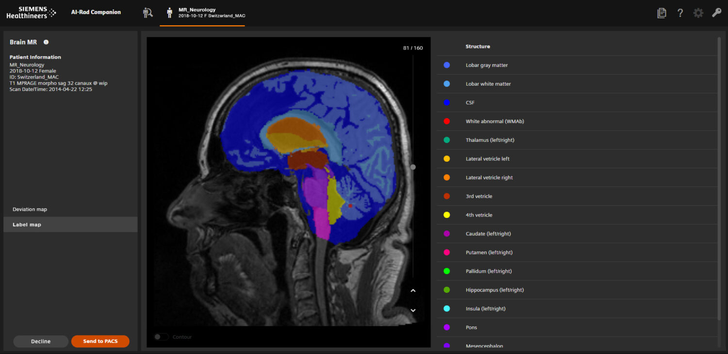 Front end of the radiology software for the extension Brain MR